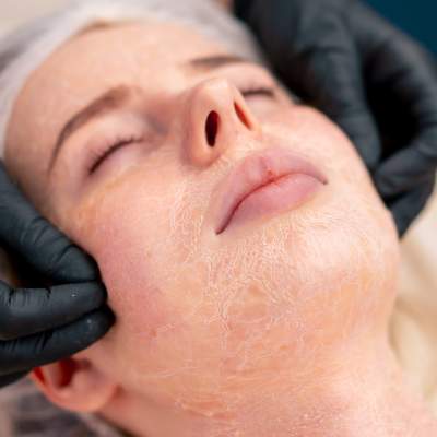 Surgical Options to Lift Sagging Skin: Understanding the Pros and Cons